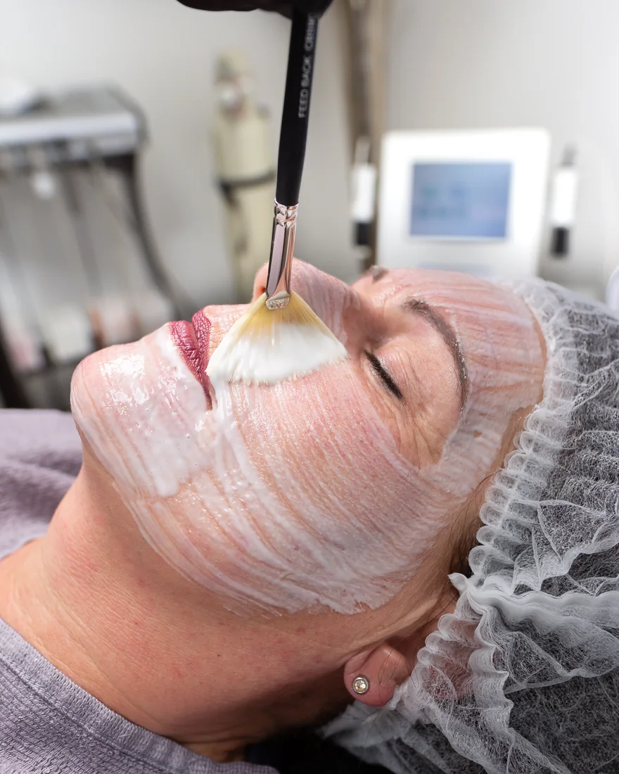 Age Smoothing Peel Behandlung im Studio – Astrid Panitz, Kaarst
