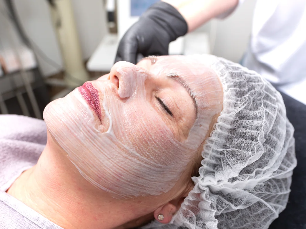 Age Smoothing Peel – Nahaufnahme der Behandlung