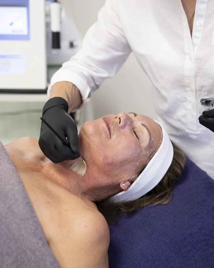 Hydra Soothing Peel Behandlung im Studio – Astrid Panitz, Kaarst