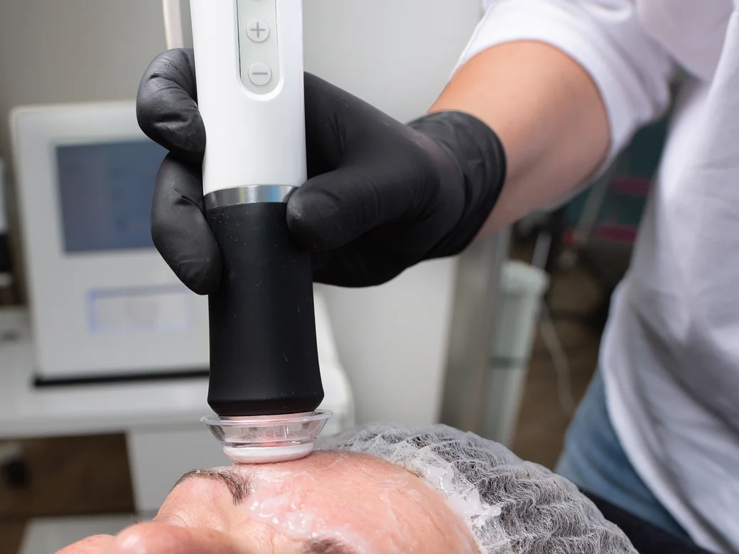 OxygeneO + Radiofrequenz – Nahaufnahme der Behandlung