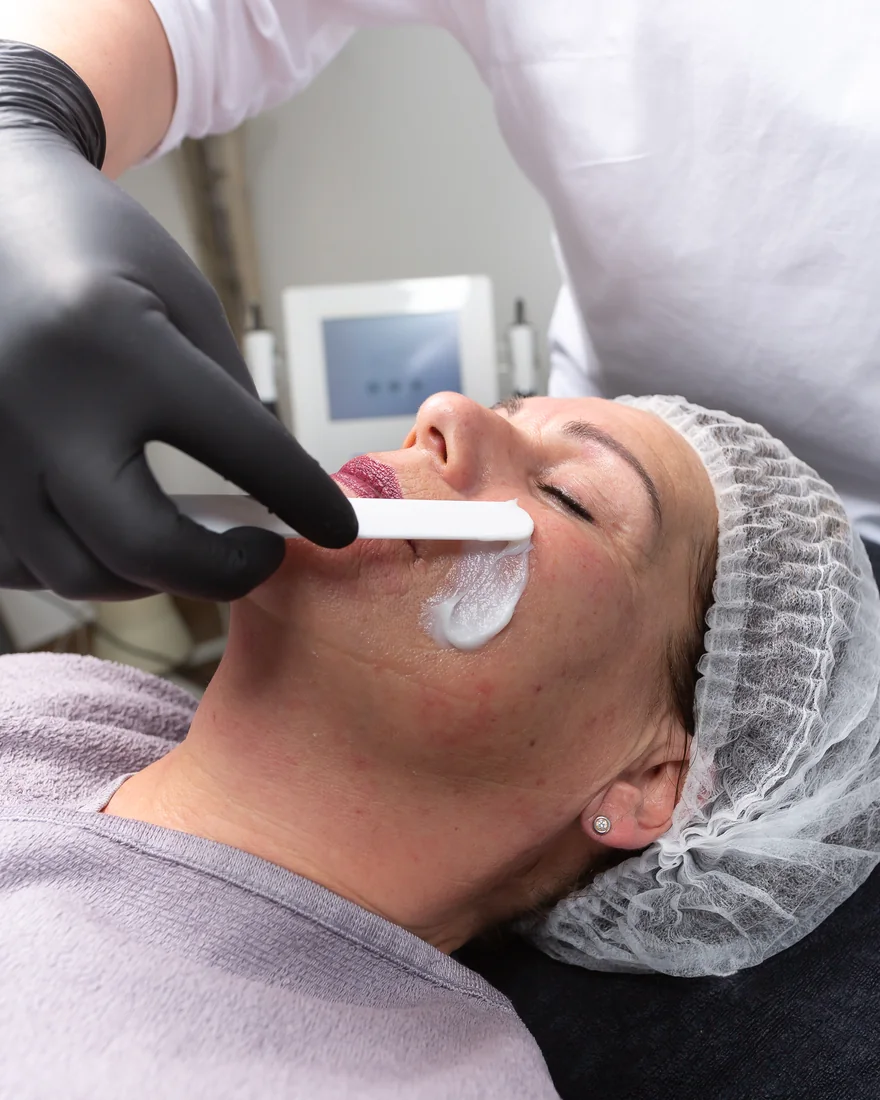 Pore Polishing Peel Behandlung im Studio – Astrid Panitz, Kaarst
