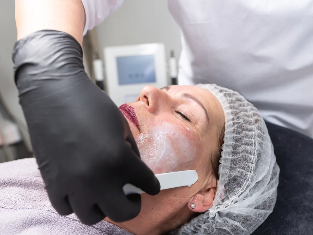 Pore Polishing Peel – Nahaufnahme der Behandlung